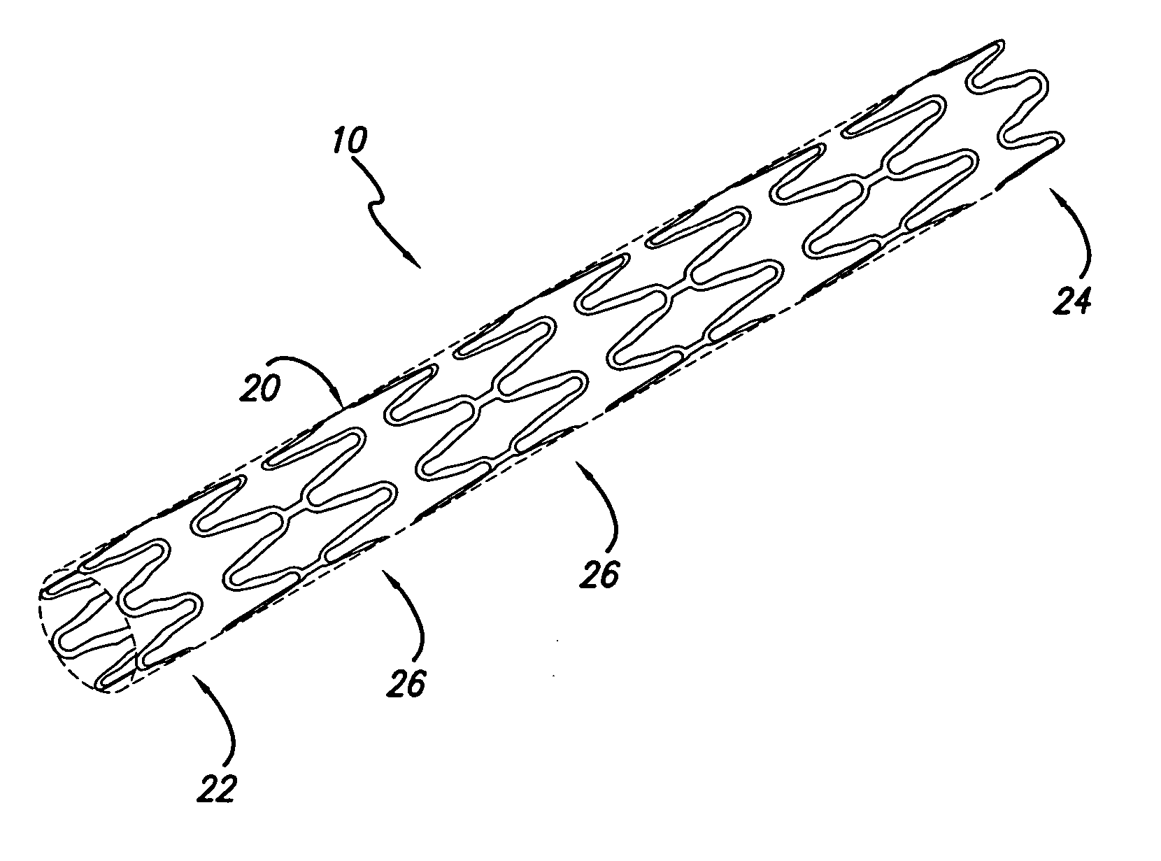 Intravascular stent