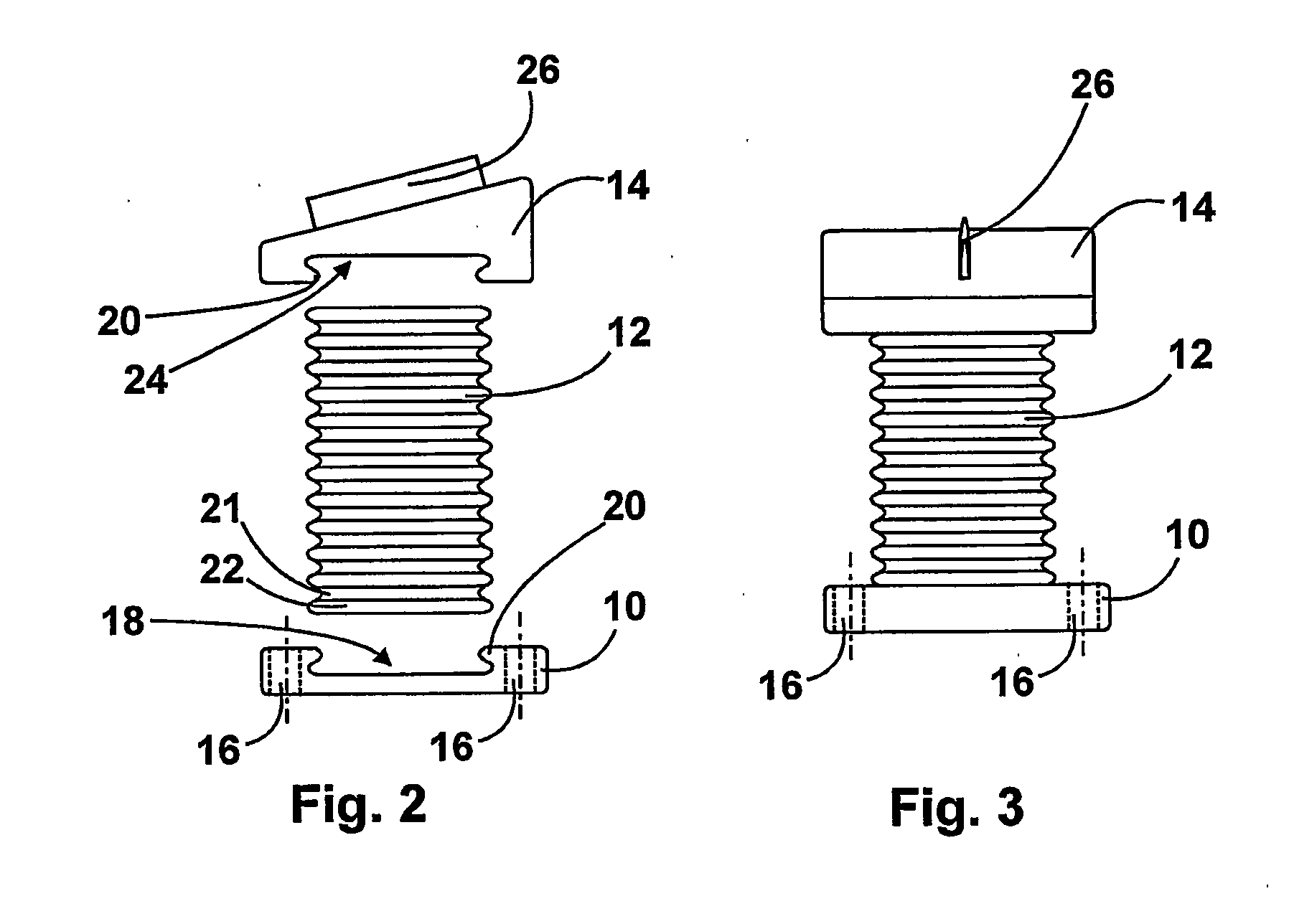 Device for implanting in a human or animal vertebral column