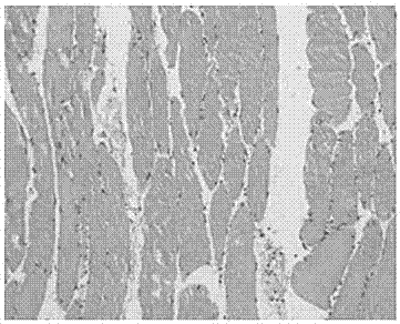 Medicine with functions of promoting blood circulation to remove blood stasis and diminishing inflammations and preparation method of medicine