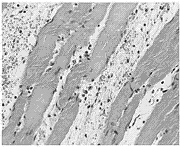 Medicine with functions of promoting blood circulation to remove blood stasis and diminishing inflammations and preparation method of medicine