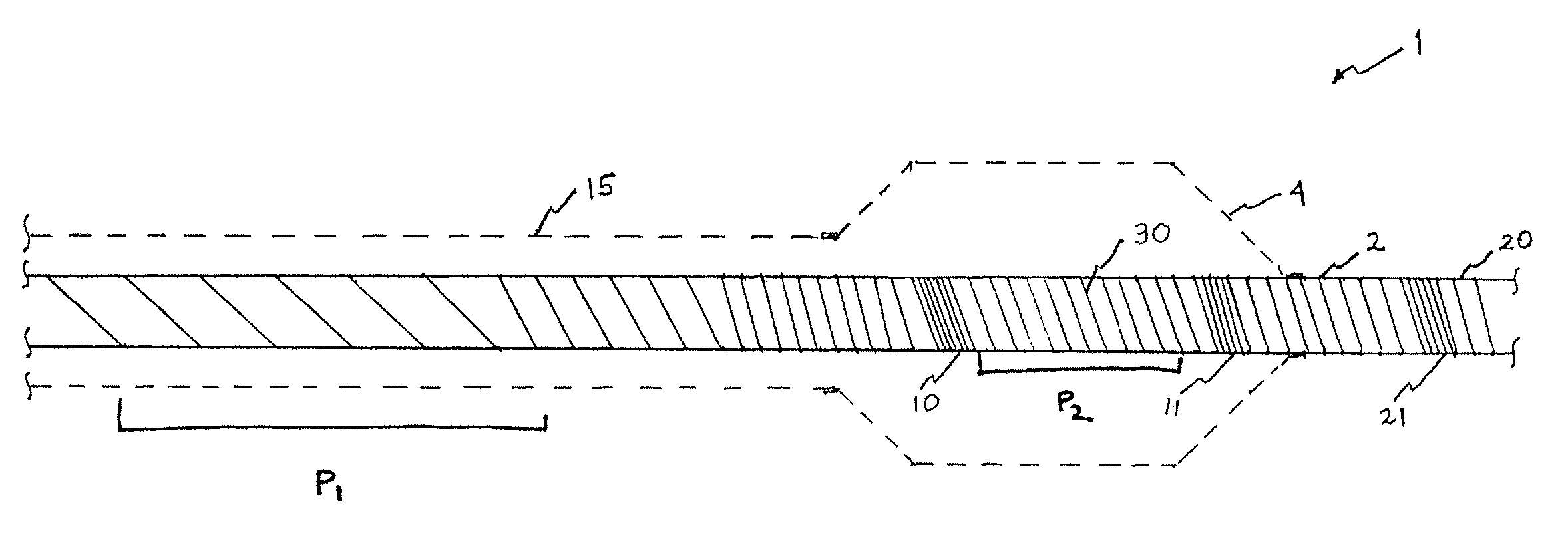 Balloon catheter with radiopaque marker