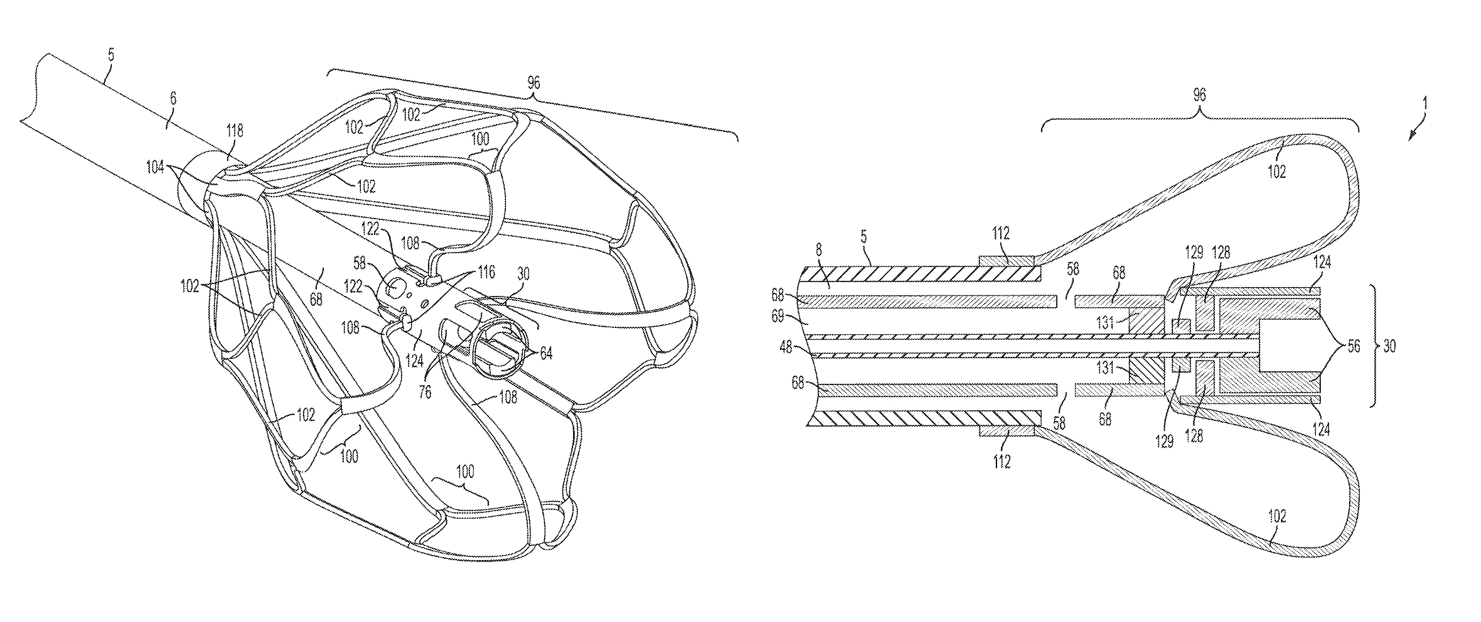 Device and method for removing material from a hollow anatomical structure