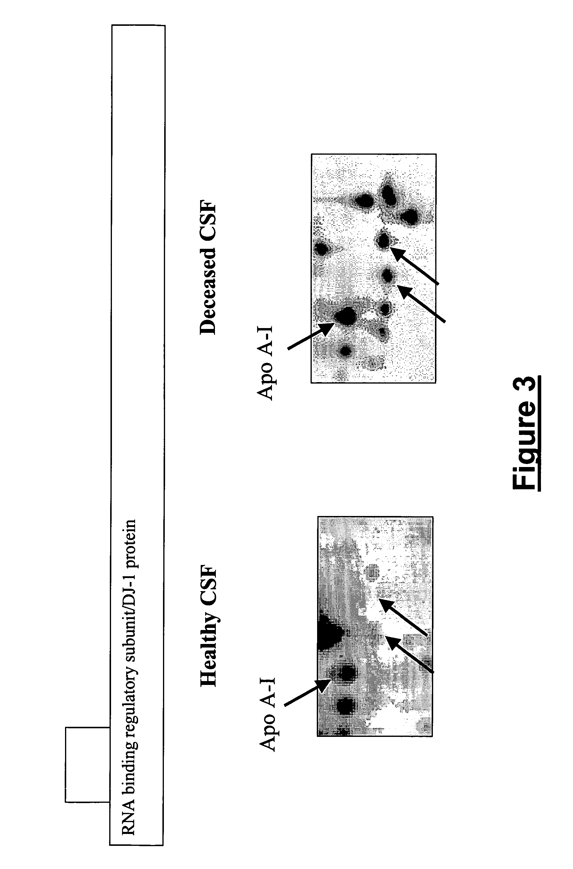 Diagnostic method for brain damage-related disorders