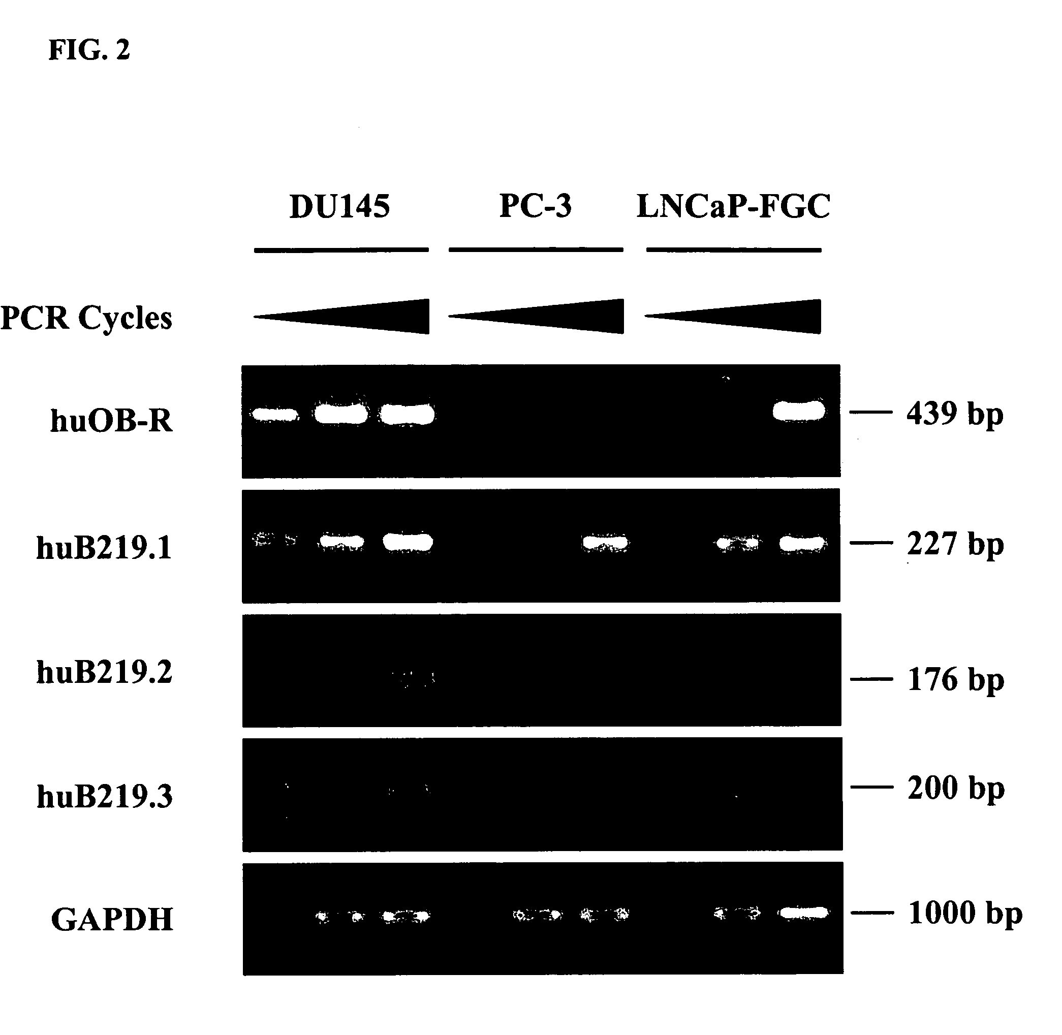 Method of treating, preventing, and diagnosing prostate cancer