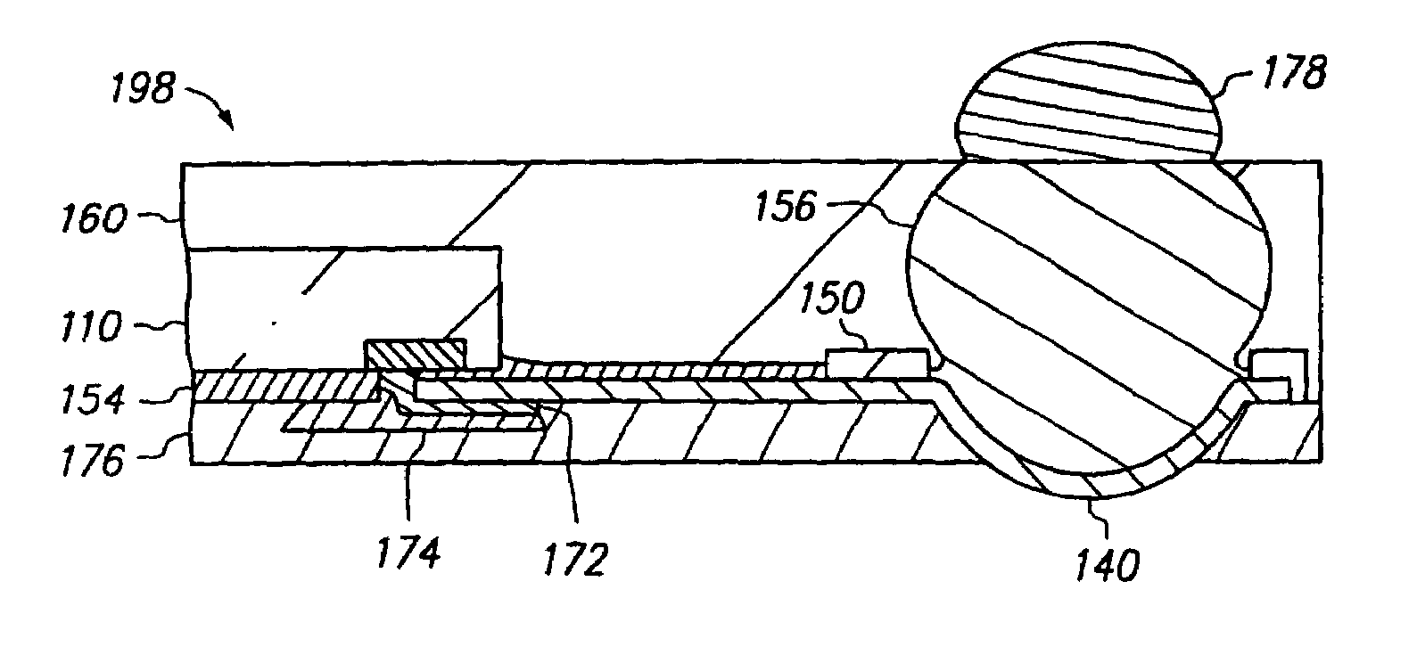 Semiconductor chip assembly with embedded metal particle