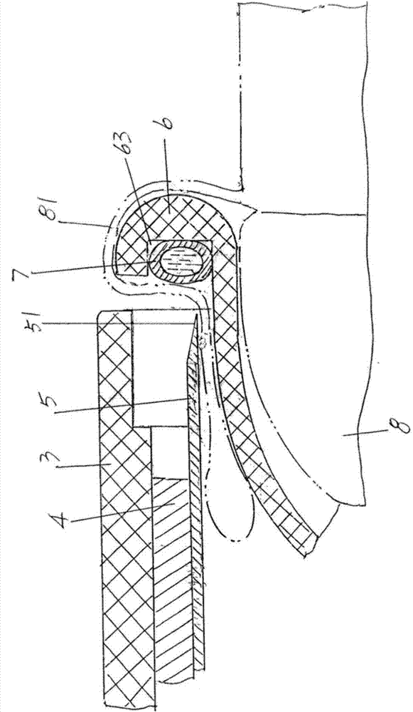 Prepuce cutting anastomat