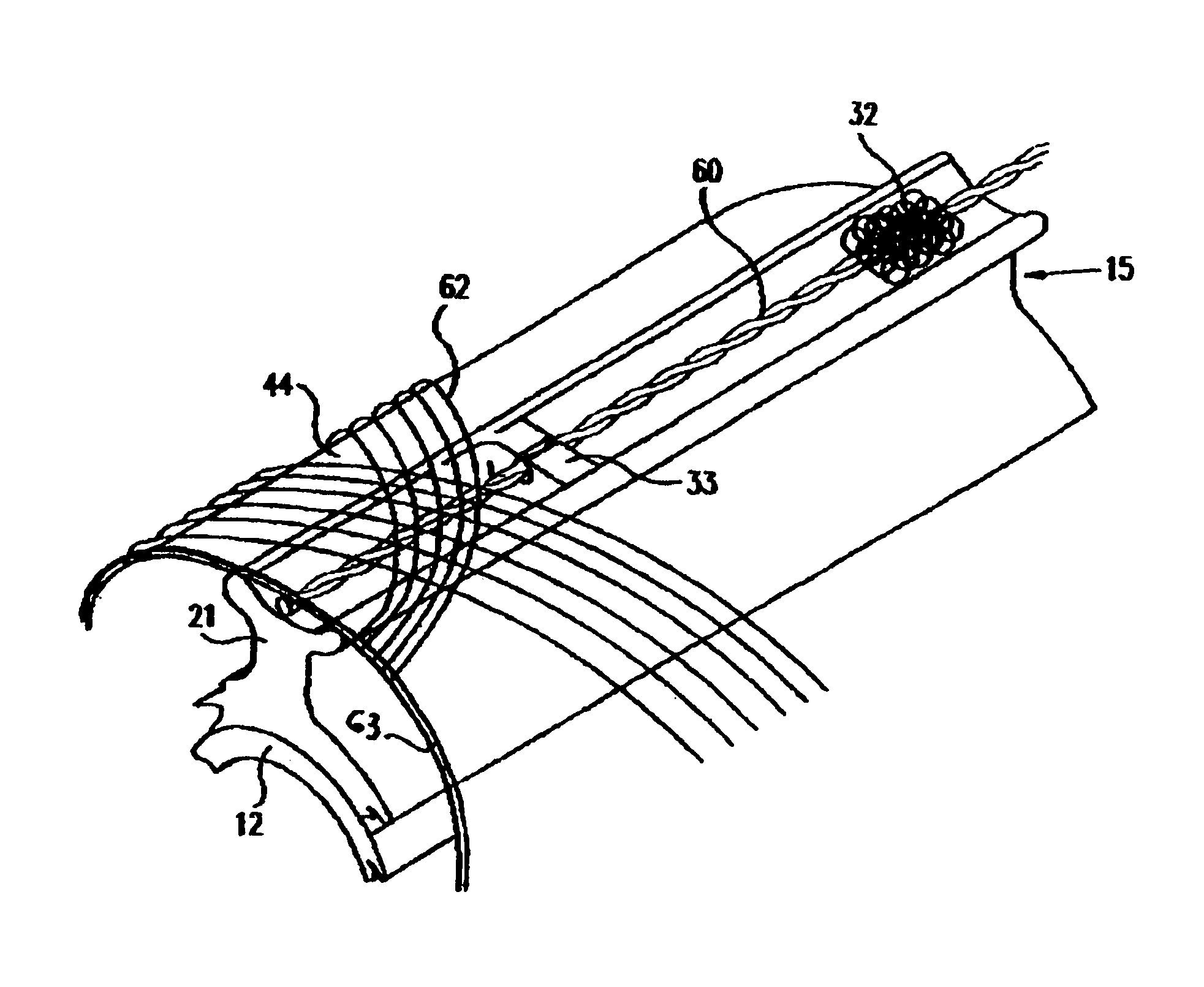 Bone growth promoting implant