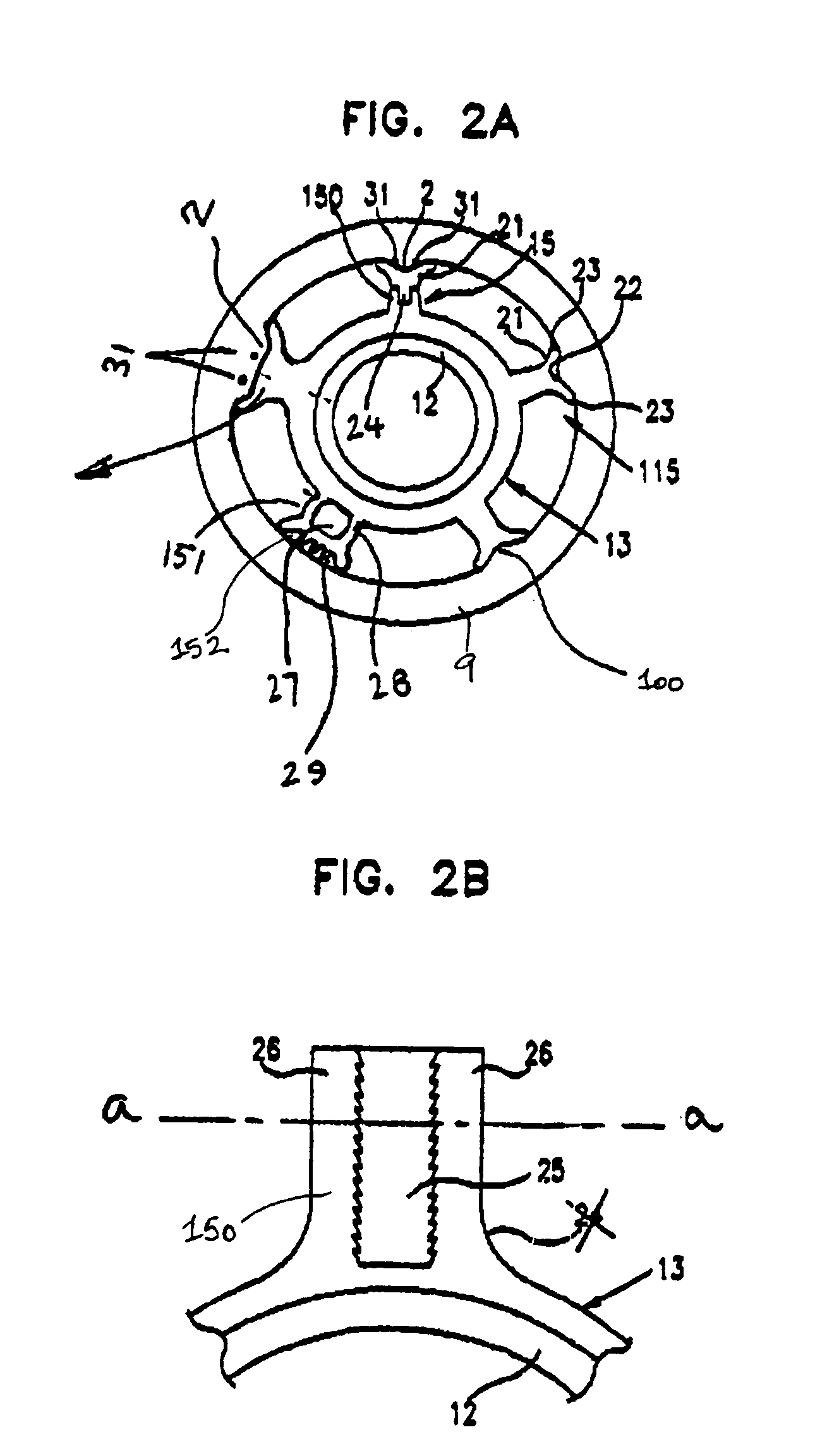 Bone growth promoting implant