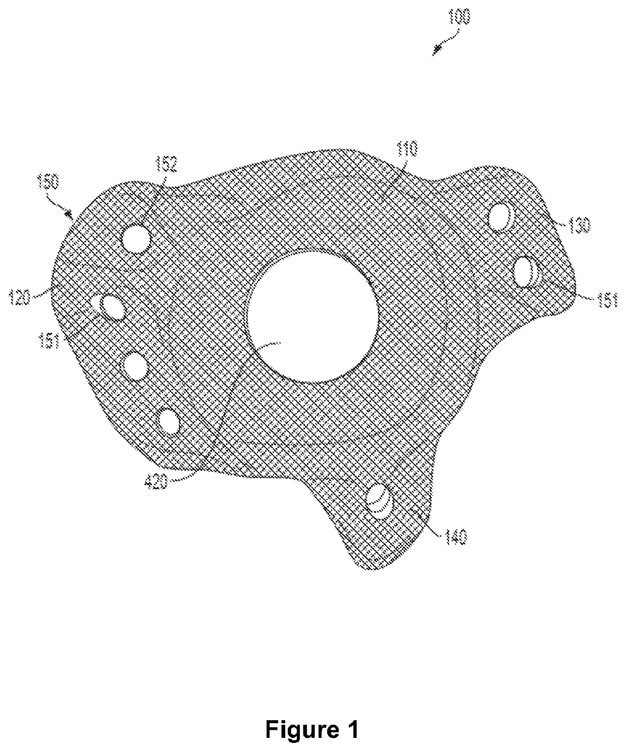 Implant surfaces