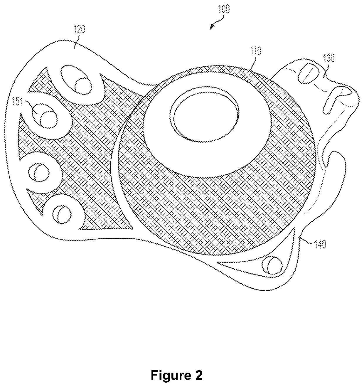 Implant surfaces