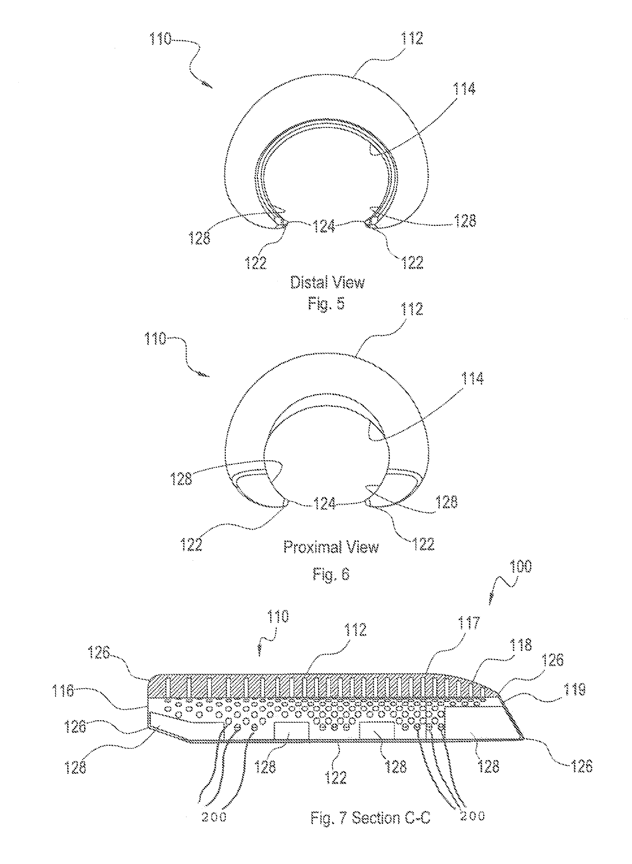 Penile implants that facilitate tissue expansion