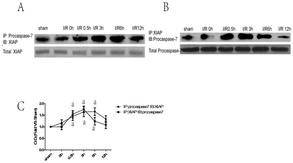 Small peptide tat-akpd for treating ischemic brain injury and its application