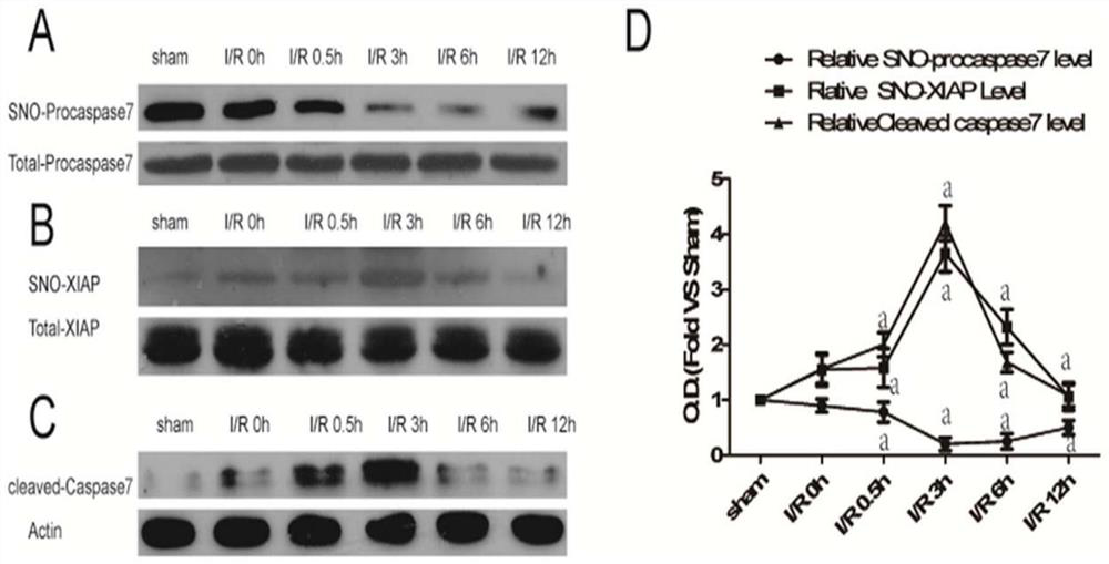 Small peptide tat-akpd for treating ischemic brain injury and its application