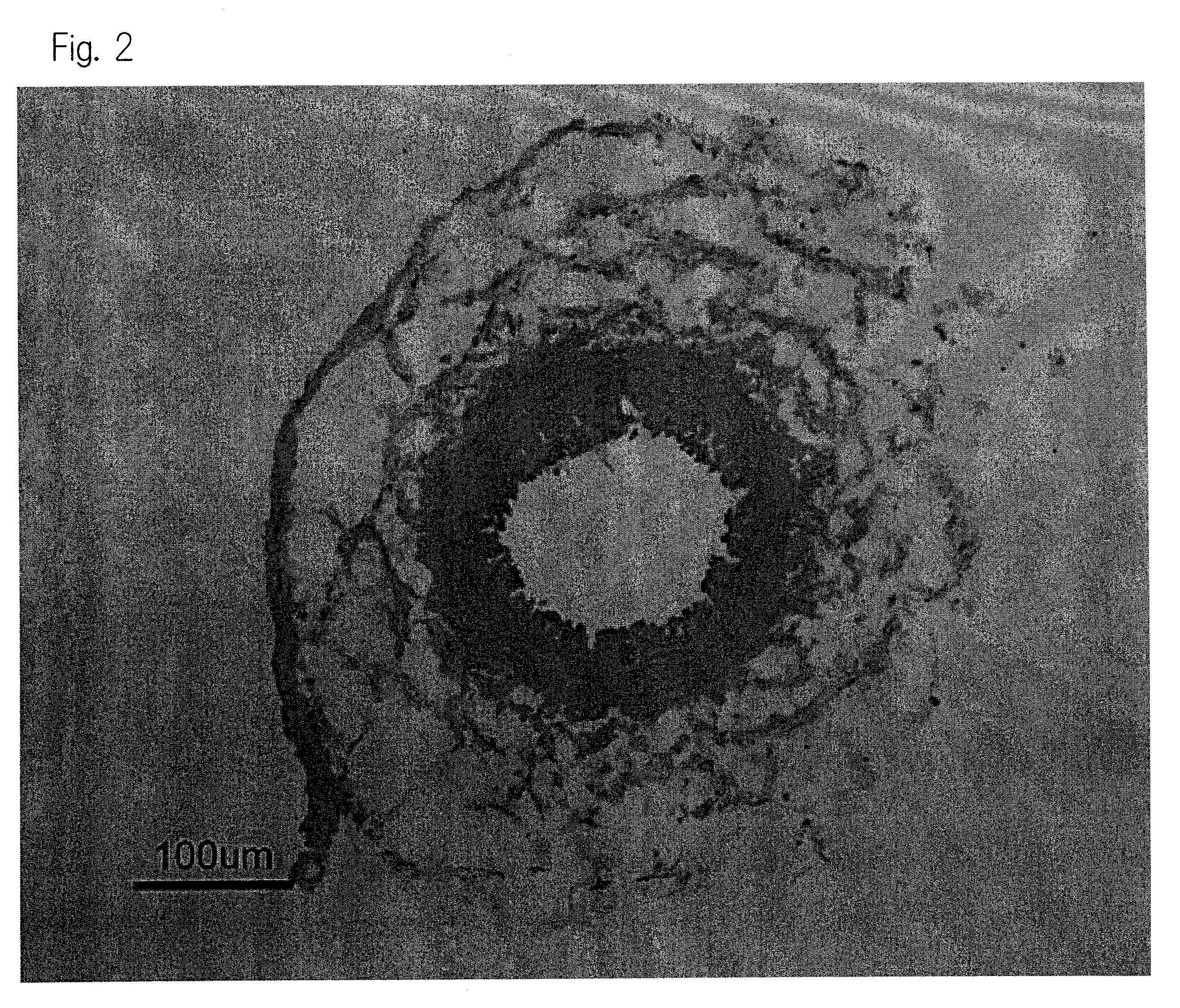 Therapeutic or prophylactic agent for vasoconstriction