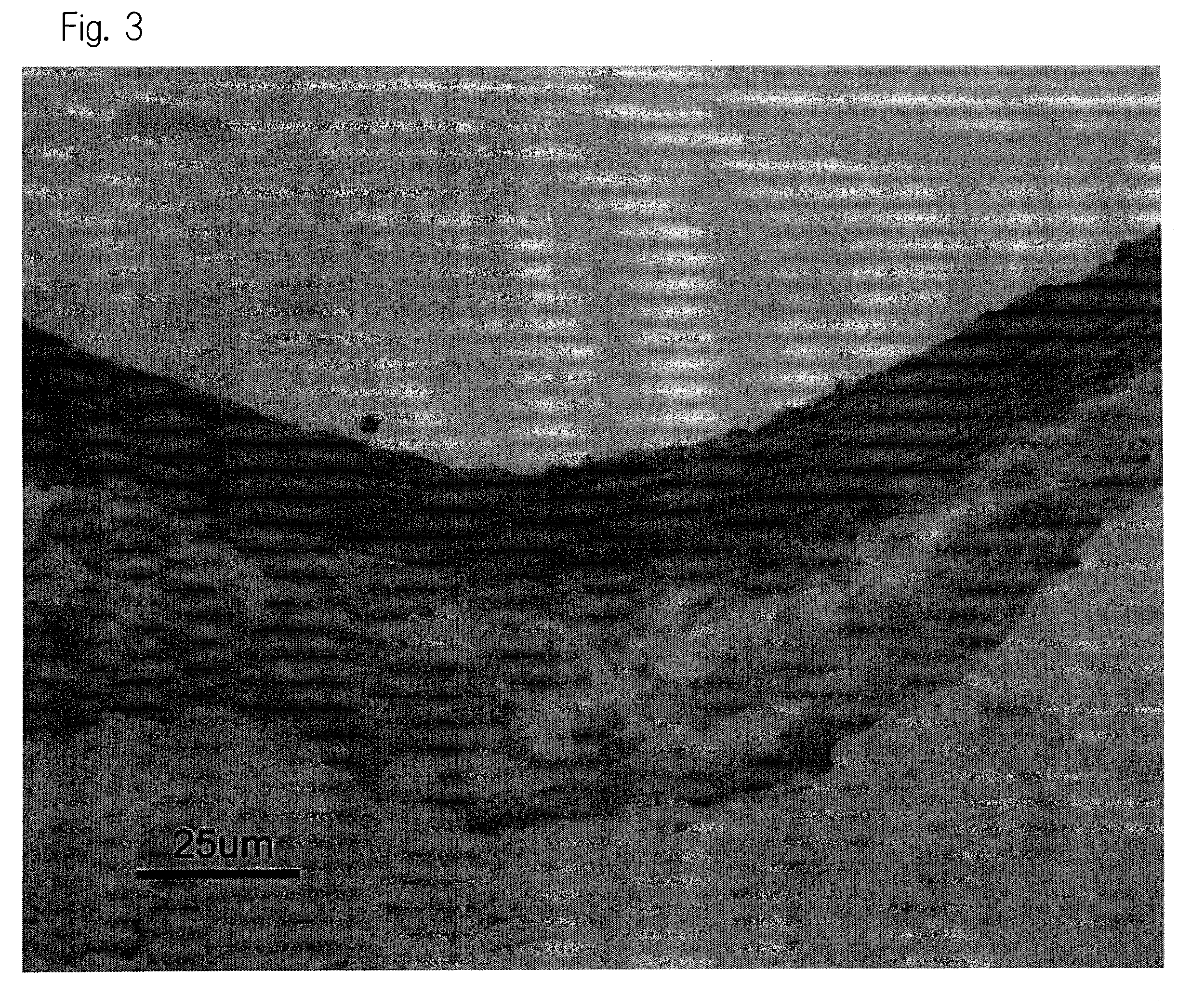 Therapeutic or prophylactic agent for vasoconstriction