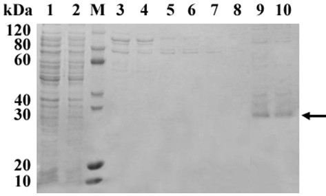 A kind of cytoglobin-human lactoferrin peptide fusion protein, gene and application