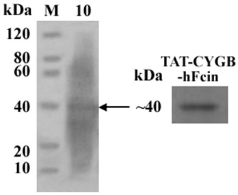 A kind of cytoglobin-human lactoferrin peptide fusion protein, gene and application