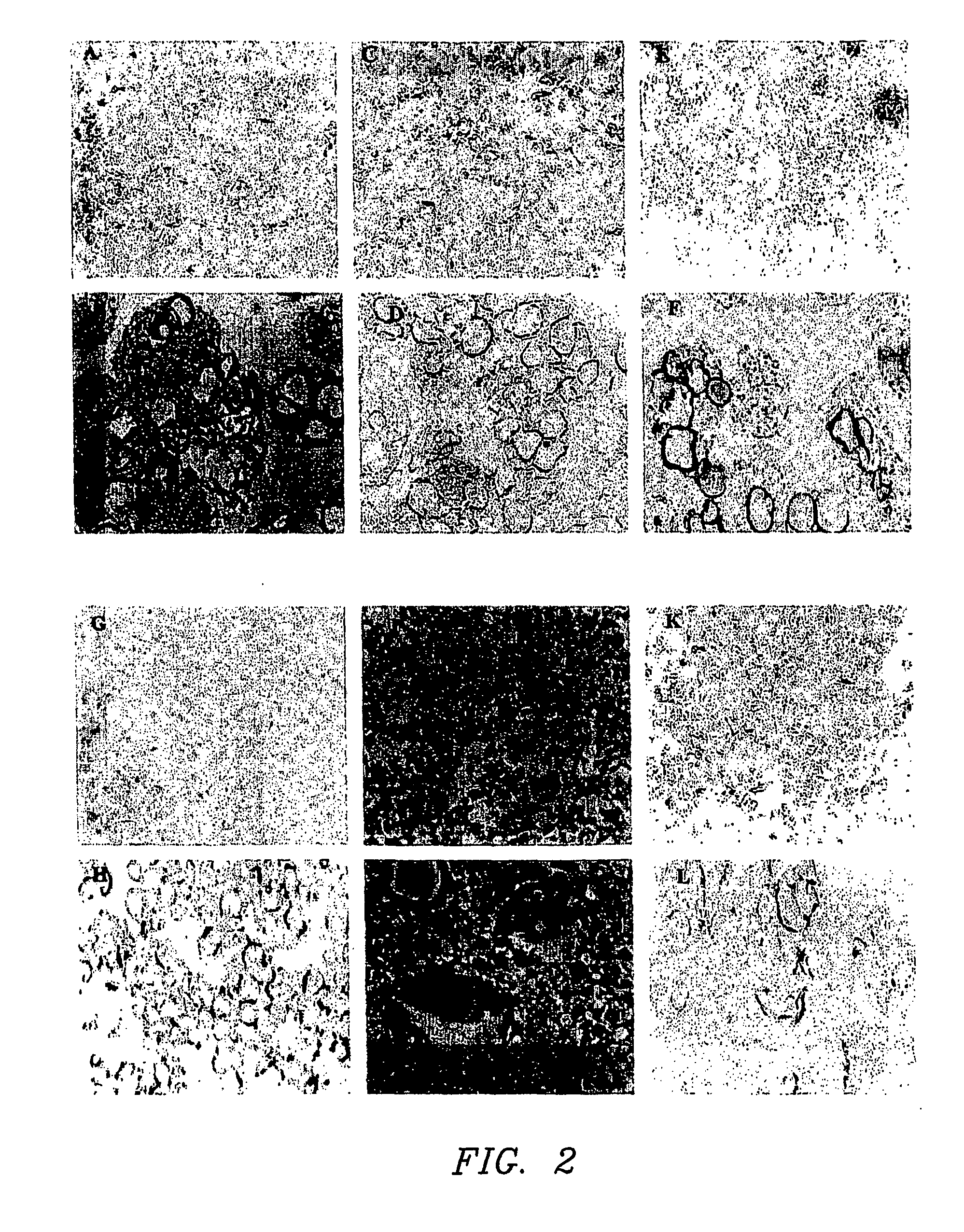 Methods for modeling infectious disease and chemosensitivity in cultured cells and tissues