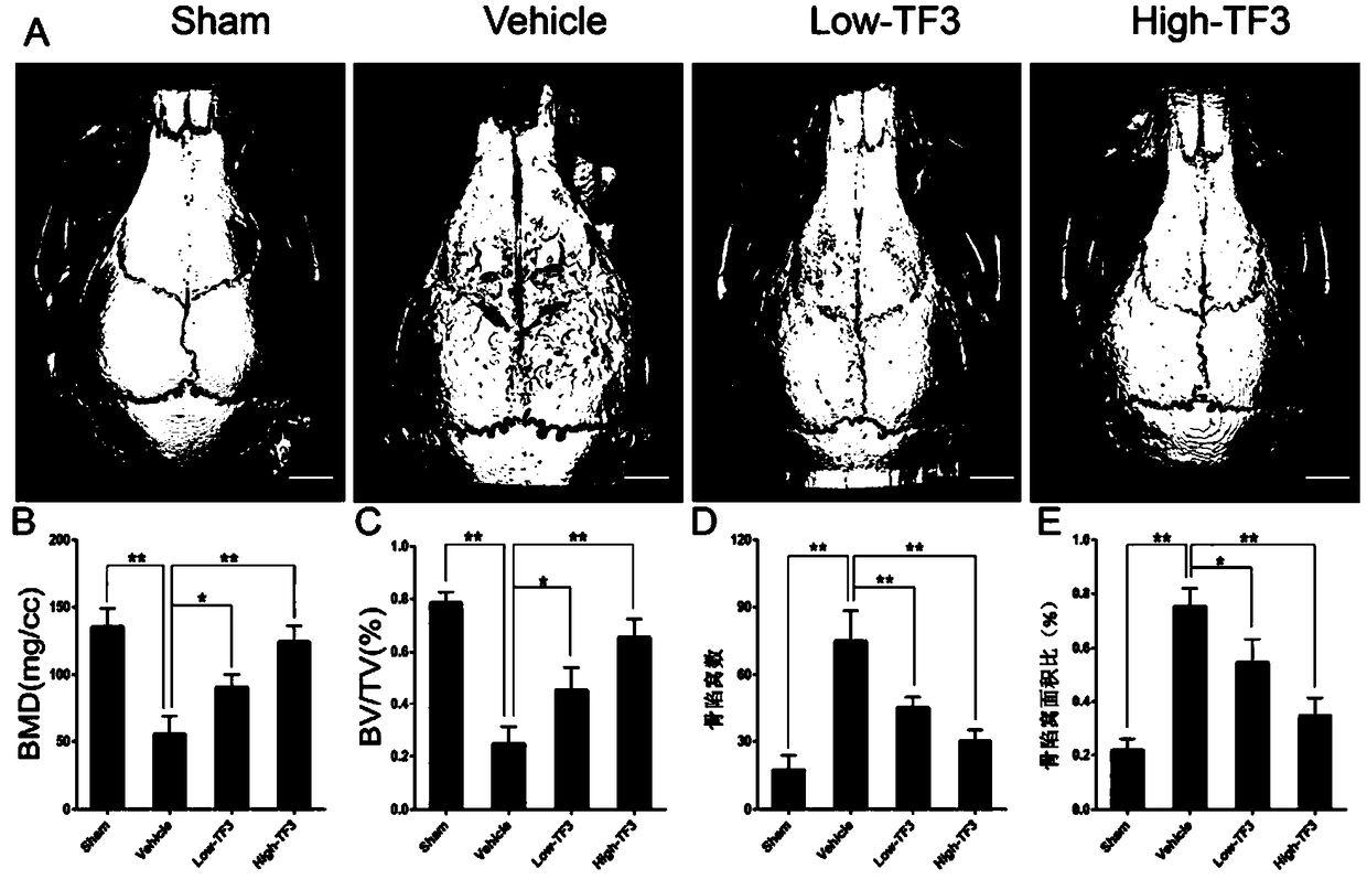 Uses of theaflavin-3,3'-digallate