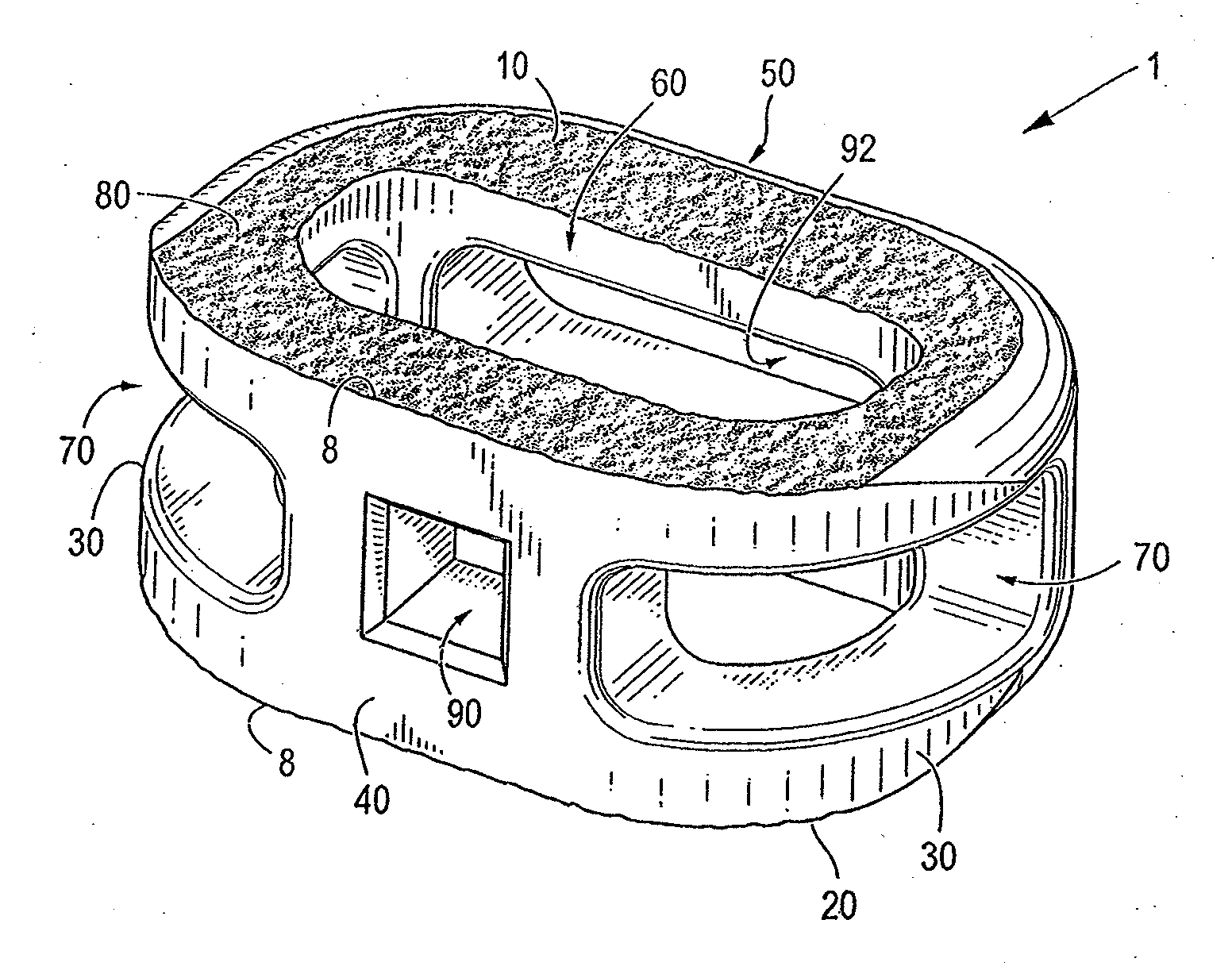 Endplate-preserving spinal implant with an integration plate having a roughened surface topography