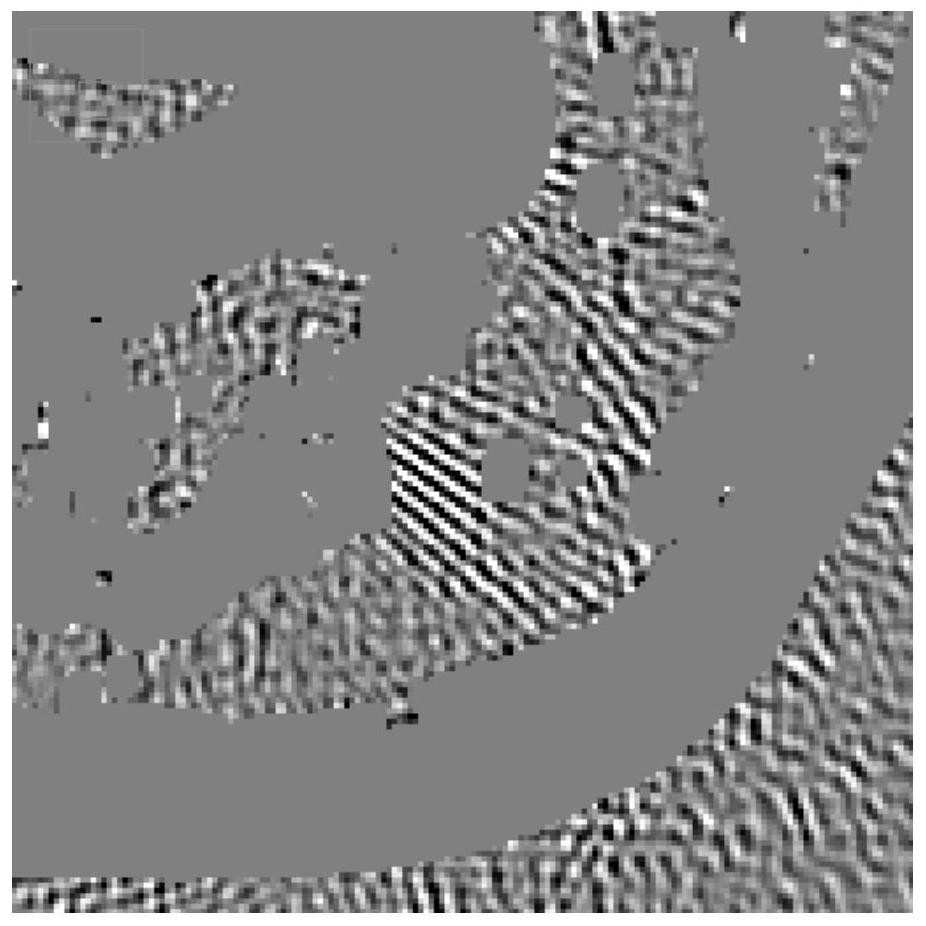 CT image artifact removing method