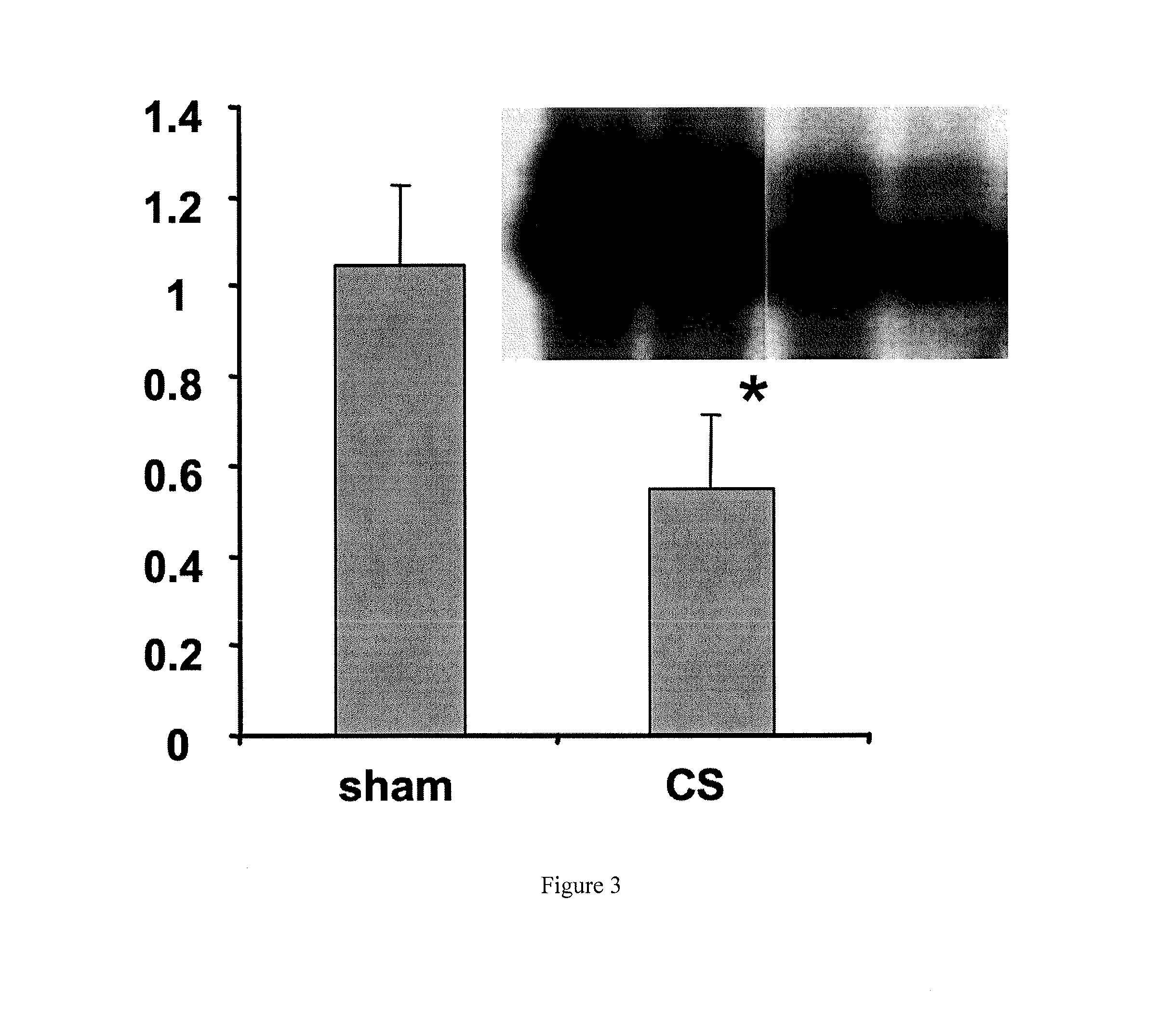 Enteral administration of sorbent polymer for treatment and prophylaxis of inflammation