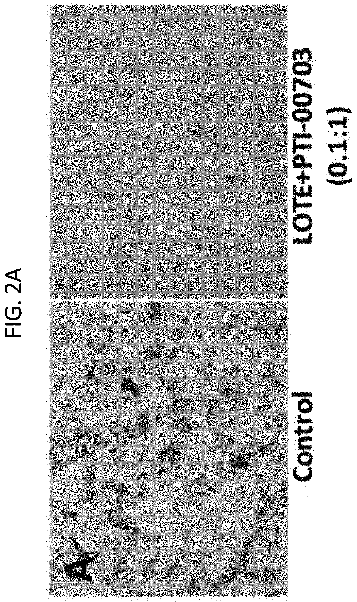 Compositions and methods for the treatment of "plaques and tangles" in humans and animals