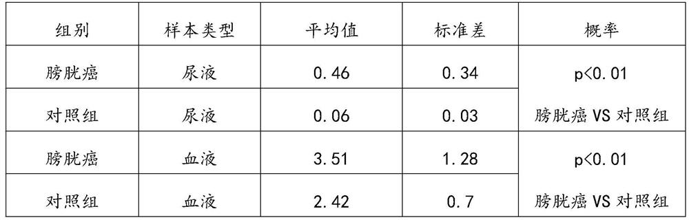 Application of combination of UP II antigen and UP II antibody in preparation of product for detecting bladder cancer