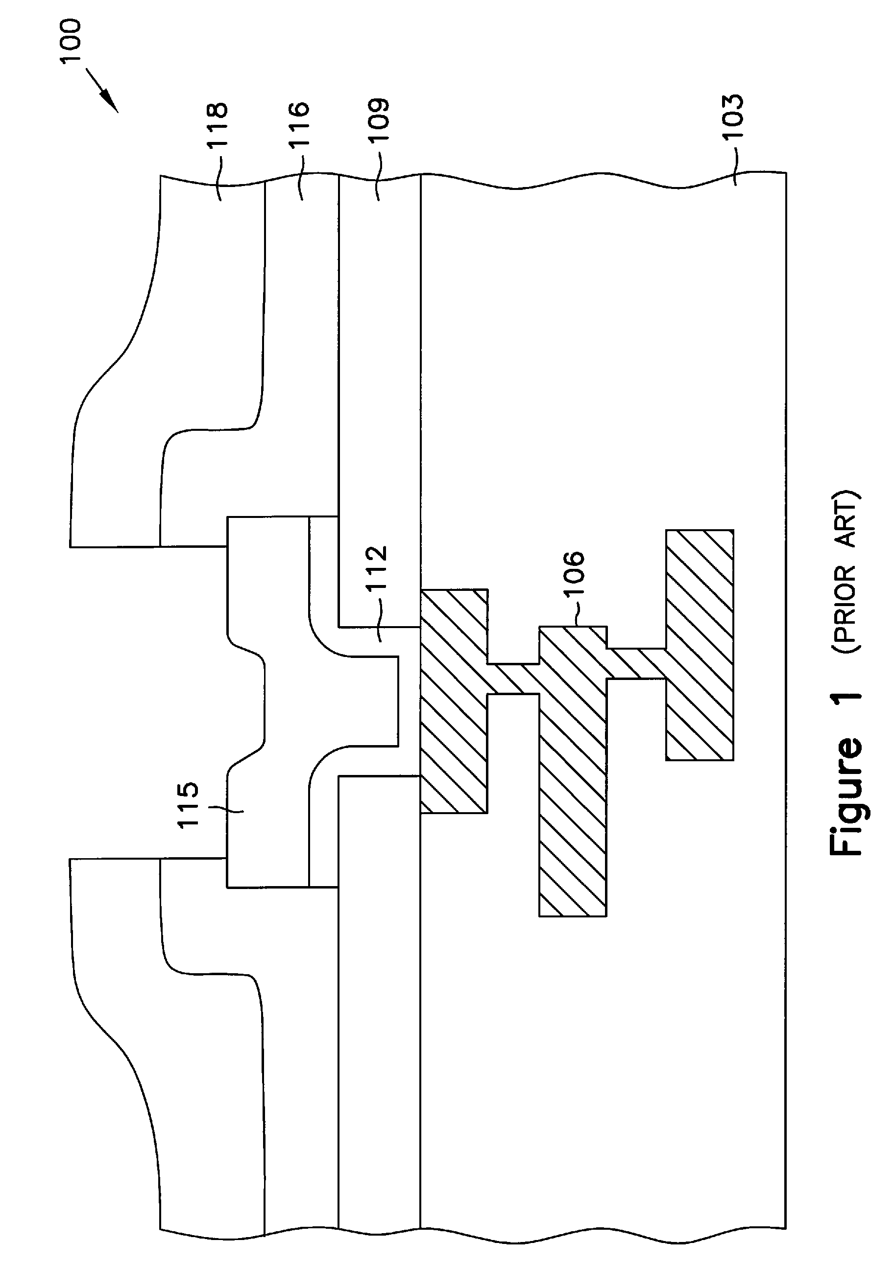 Local multilayered metallization