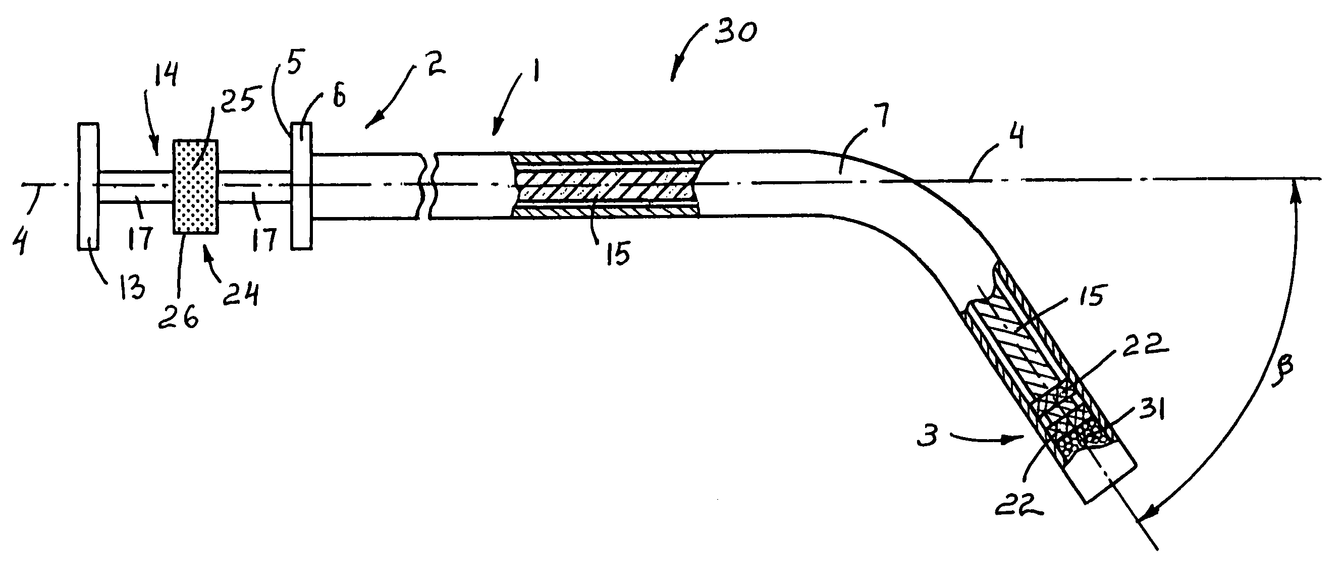 Apparatus for dental implant treatment