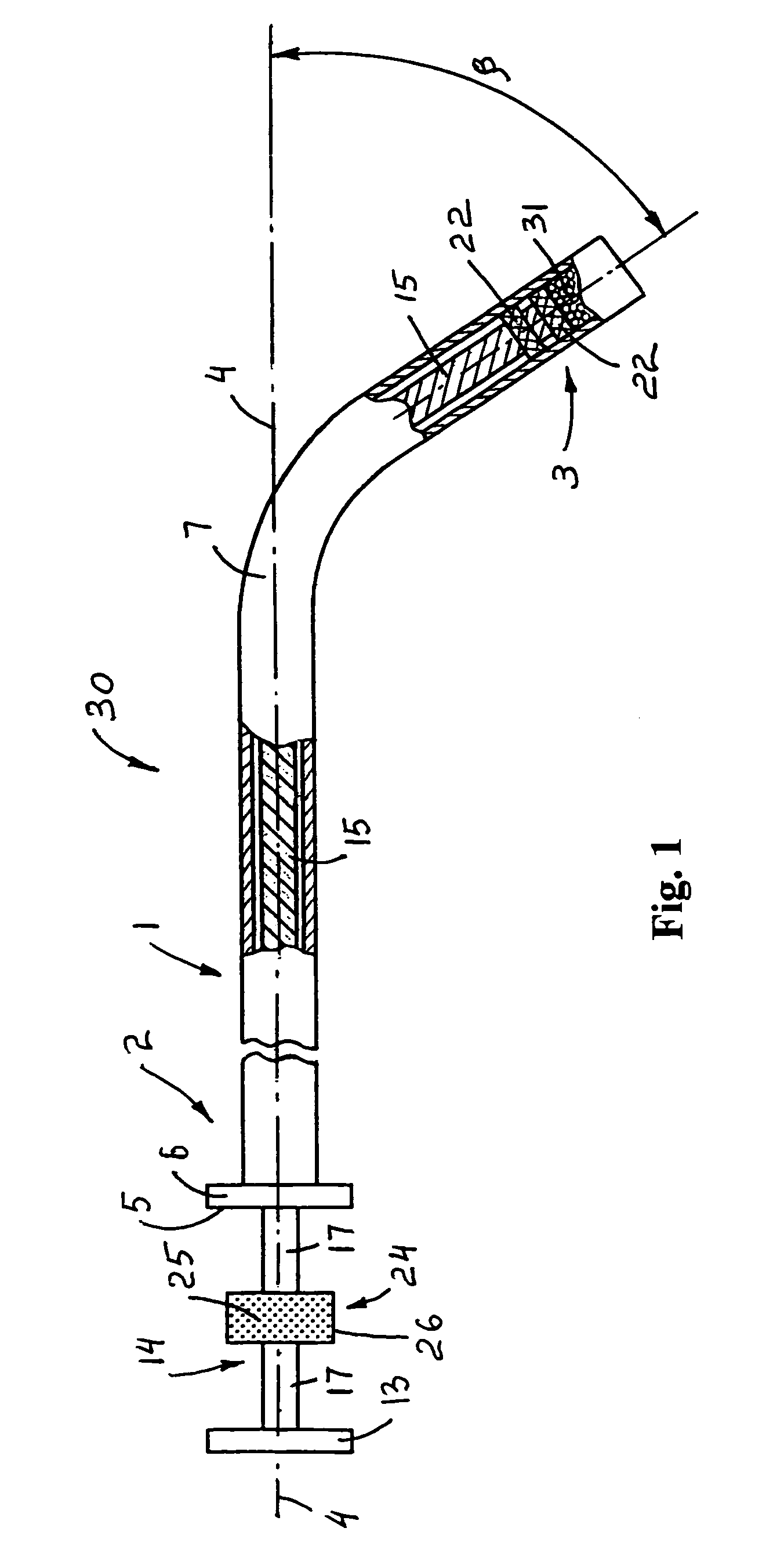 Apparatus for dental implant treatment