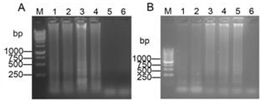 Primer composition, corresponding kit and detection method for rt-lamp detection of live bacteria of Mycobacterium tuberculosis