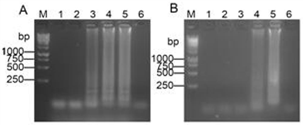 Primer composition, corresponding kit and detection method for rt-lamp detection of live bacteria of Mycobacterium tuberculosis