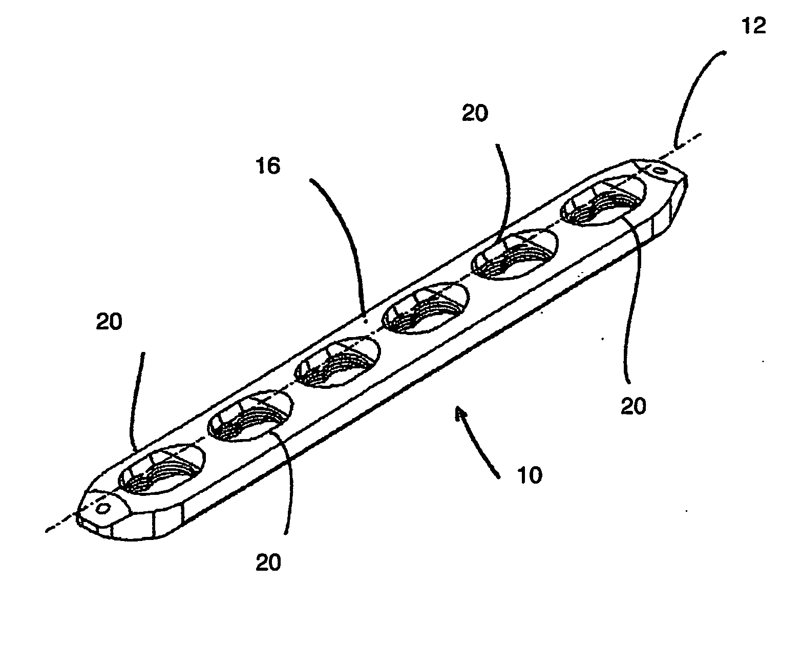 Locking bone plate