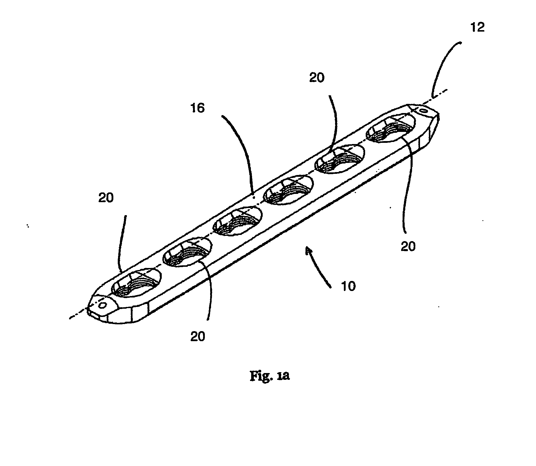 Locking bone plate