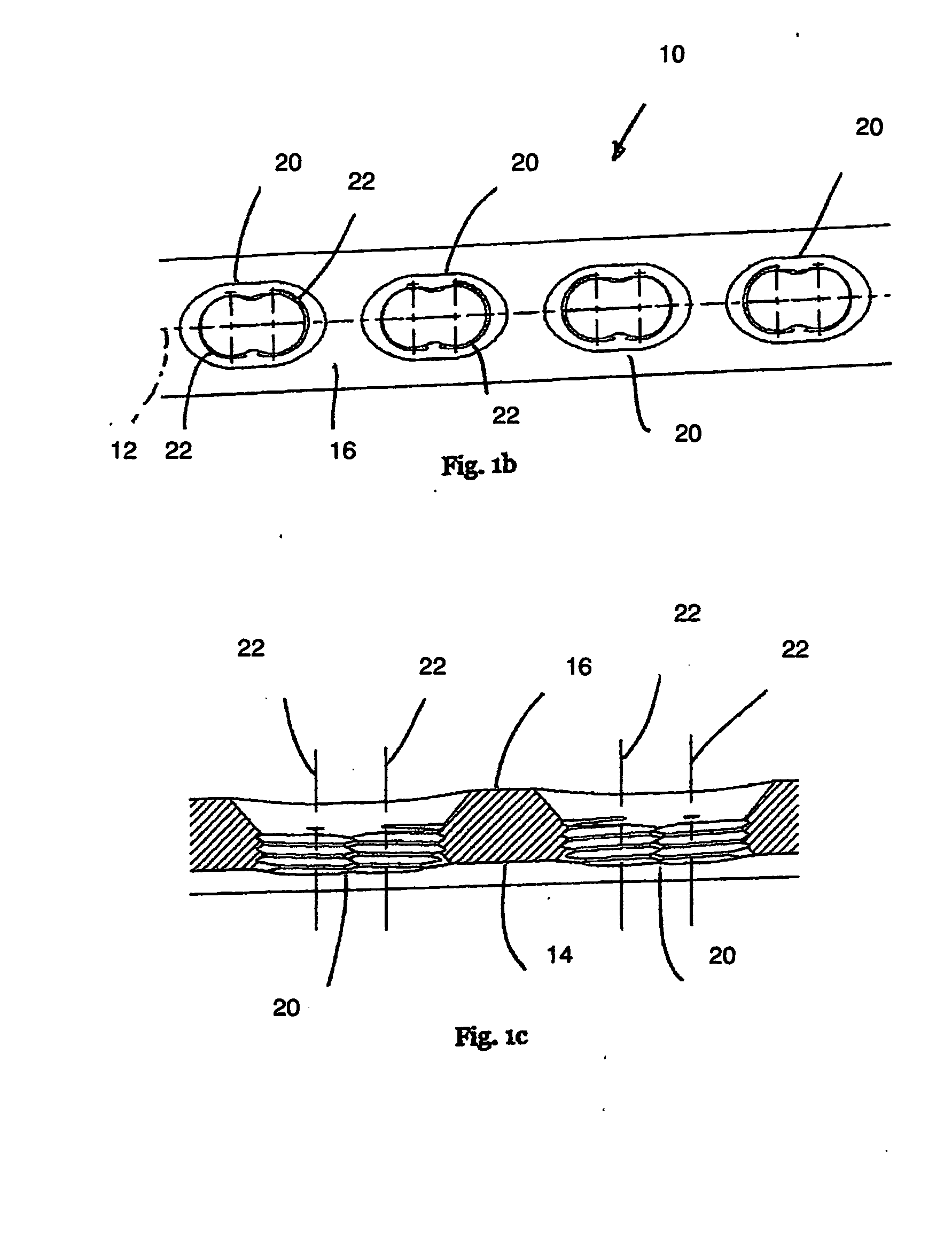 Locking bone plate