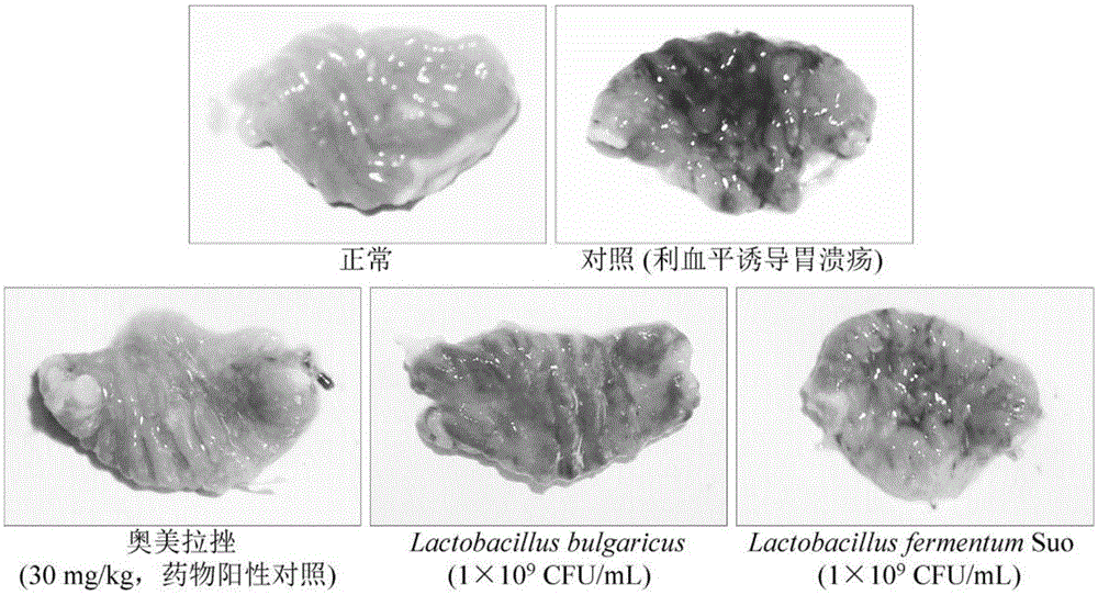 Lactobacillus fermentum strain suo capable of preventing gastric ulcers and application of lactobacillus fermentum strain suo