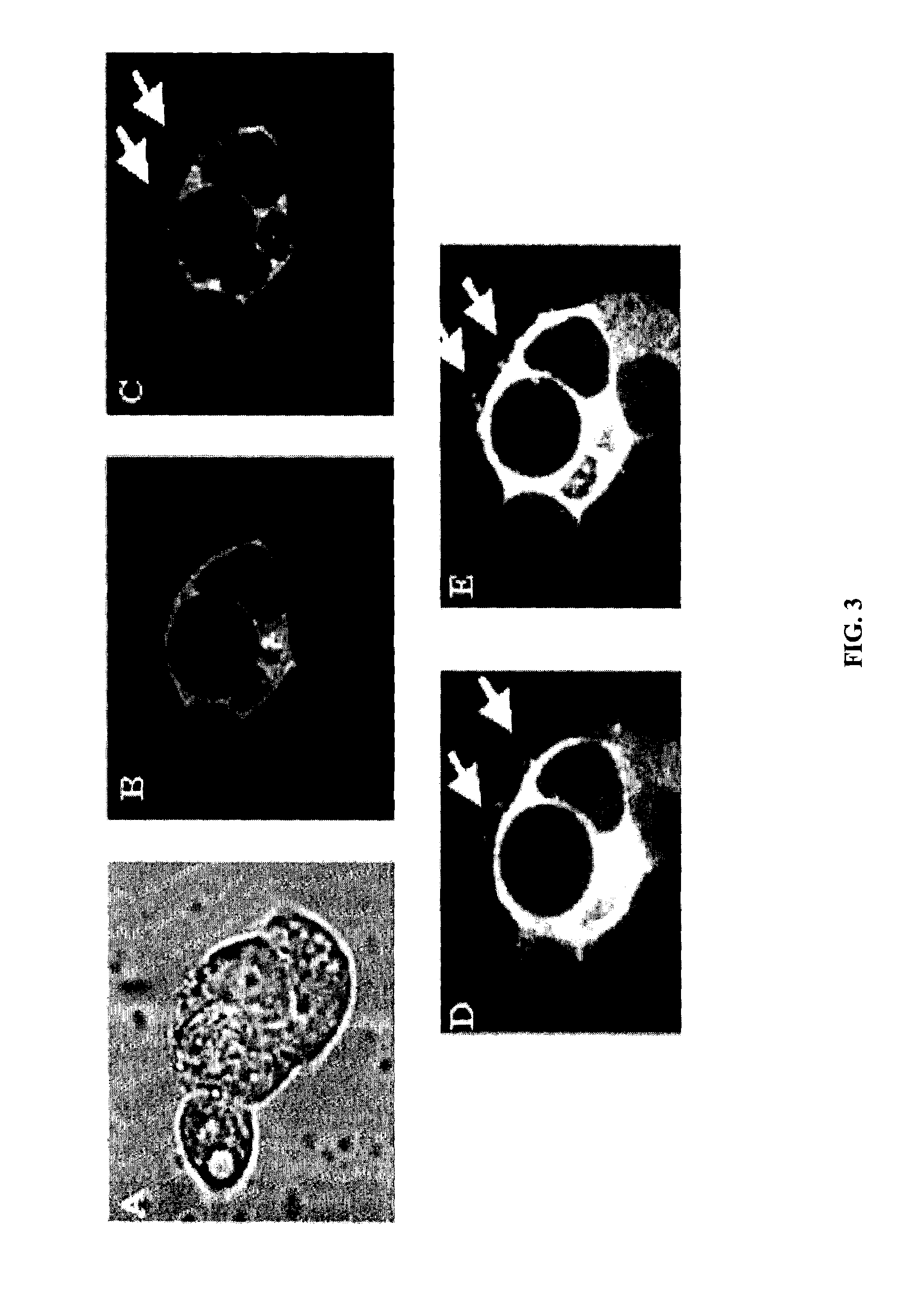 Anti-TSG101 antibodies and their uses for treatment of viral infections