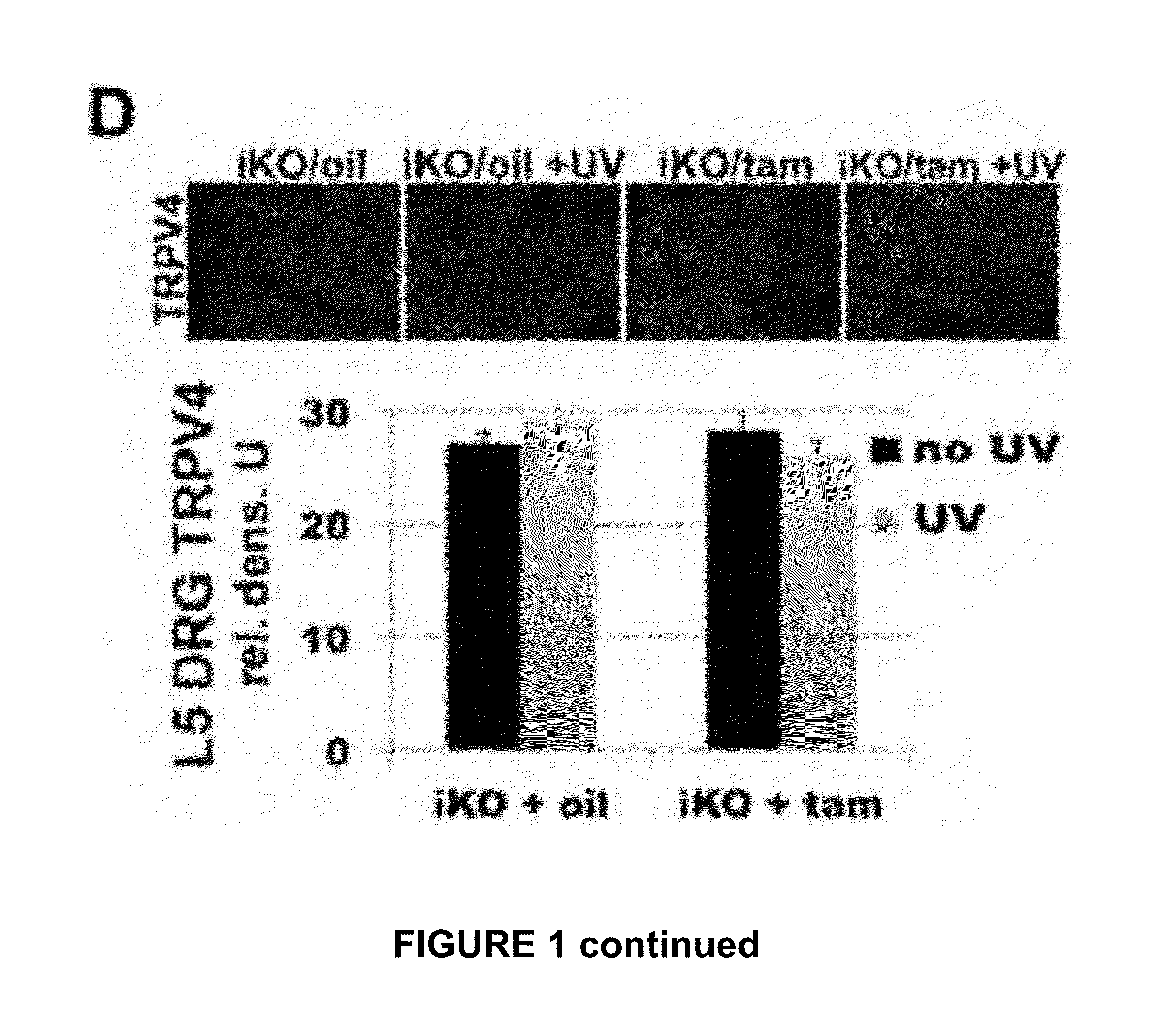 Trpa1 and trpv4 inhibitors and methods of using the same for organ-specific inflammation and itch