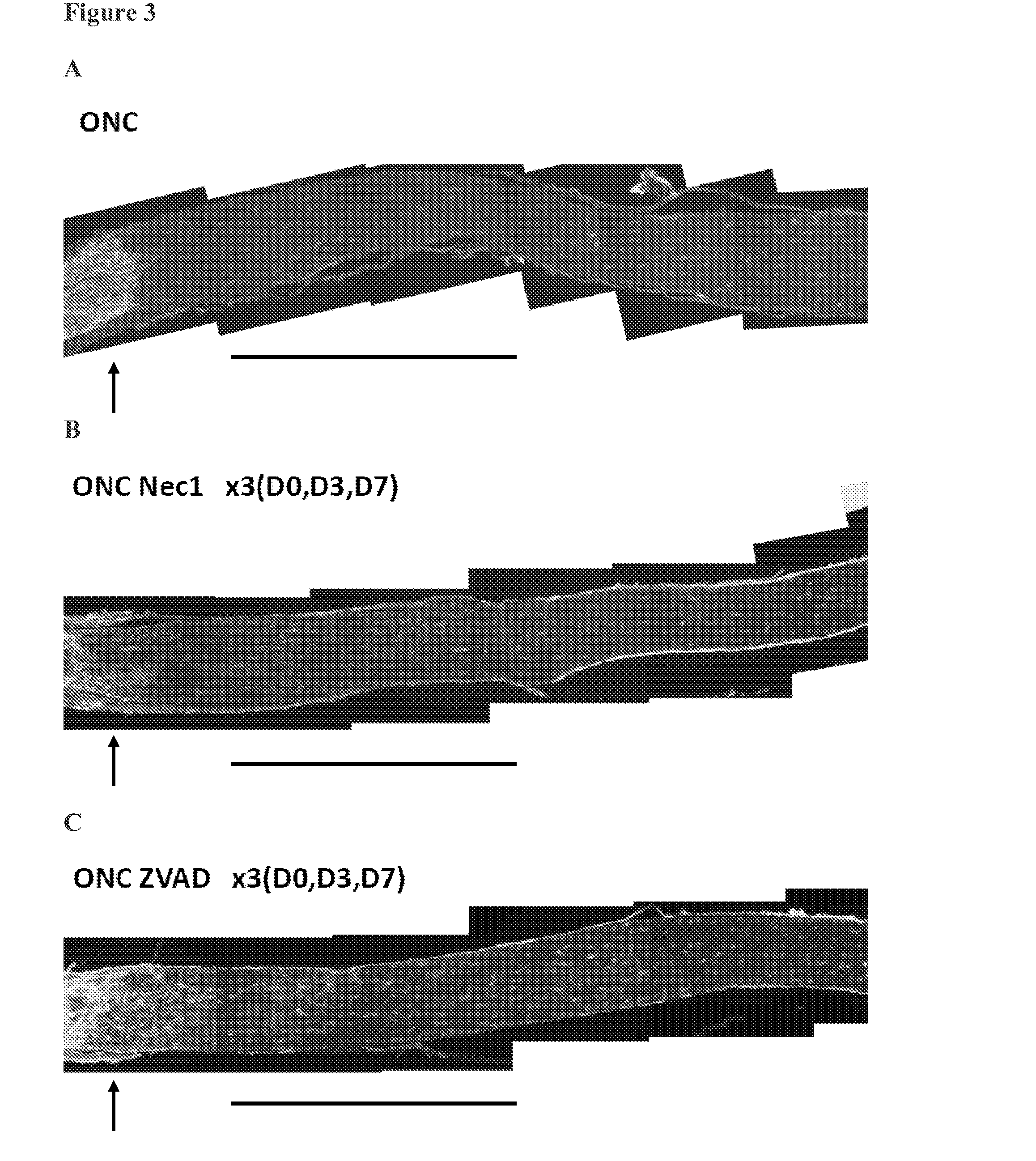 Compositions comprising necrosis inhibitors, such as necrostatins, alone or in combination, for promoting axon regeneration and nerve function, thereby treating CNS disorders