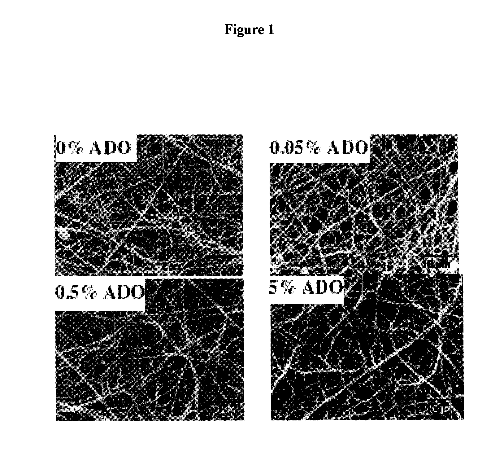 Fibrous scaffold for use in soft tissue engineering