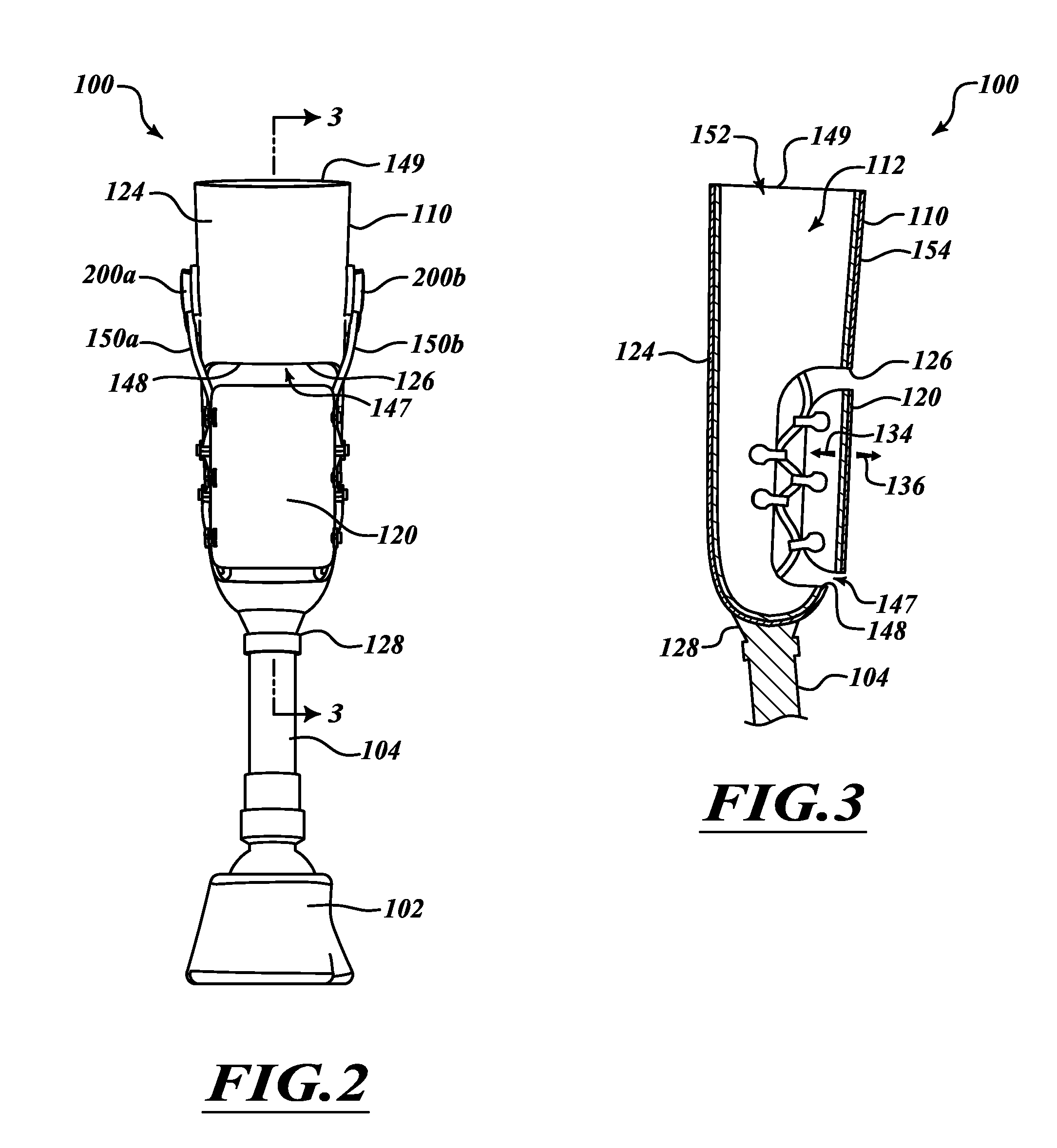 Adjustable prosthesis