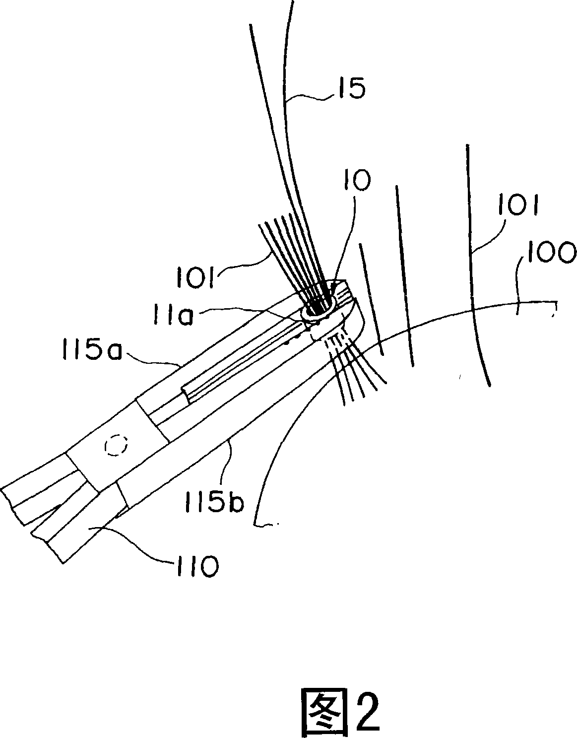 Fitting tool for hair, wig equipped with the same, method of wearing the wig, and compression application tool for wig wearing