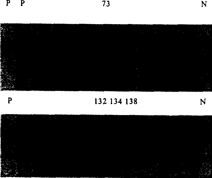 Method of producing human forcing erythrogenin using transgene animal mammary gland