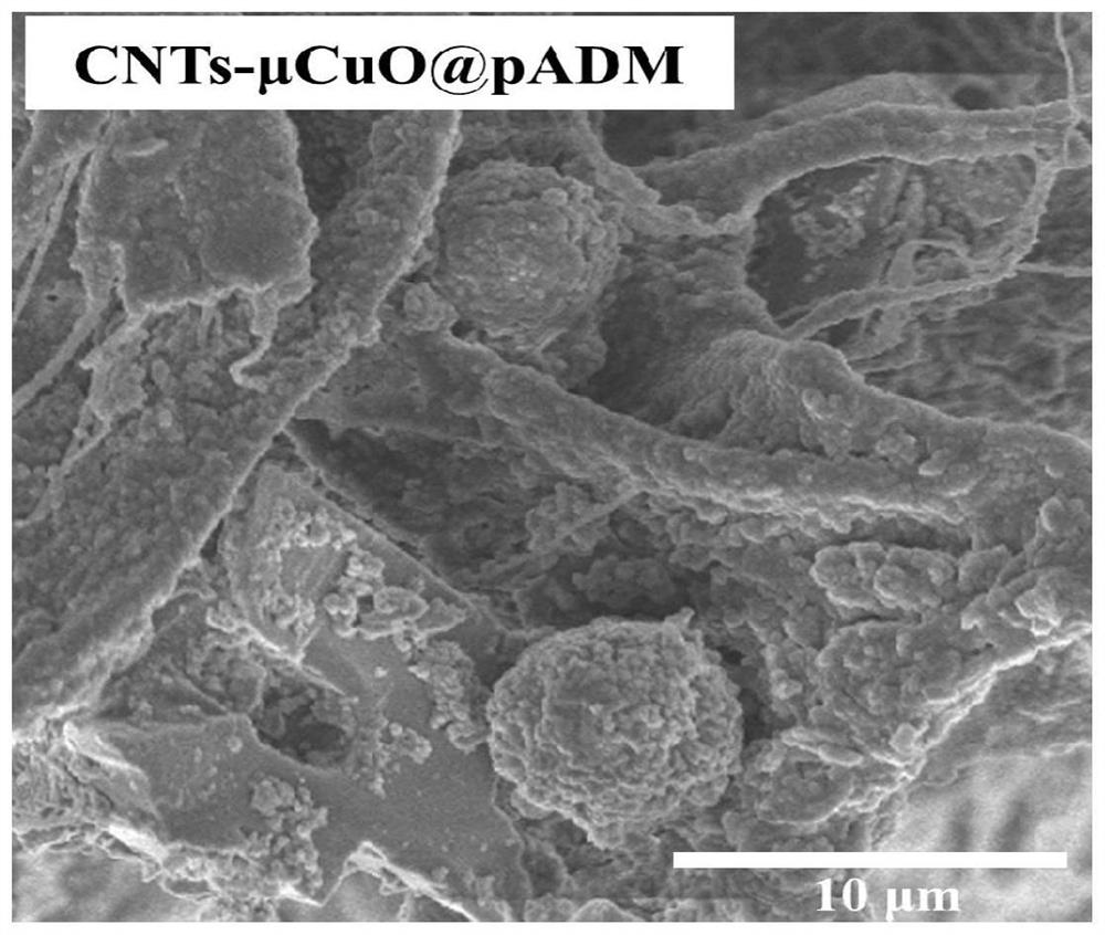 Preparation method and application of acellular porcine dermal matrix antibacterial conductive skin scaffold