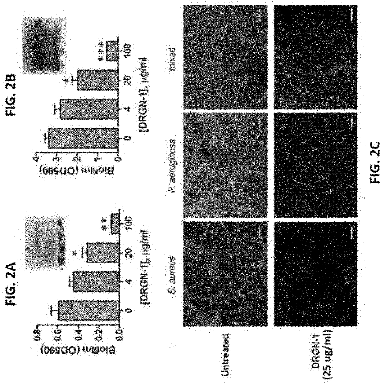 Antimicrobial peptides with wound healing activity