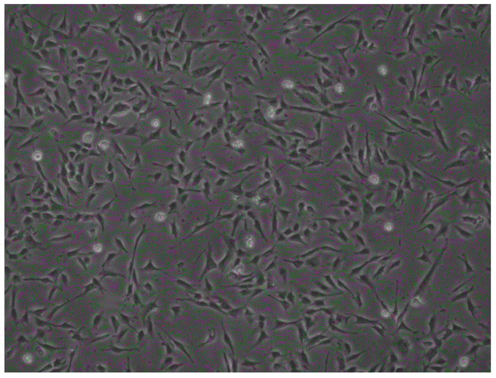 Method for improving proliferation ability and performance of umbilical cord blood OECs (outgrowth endothelial cells)