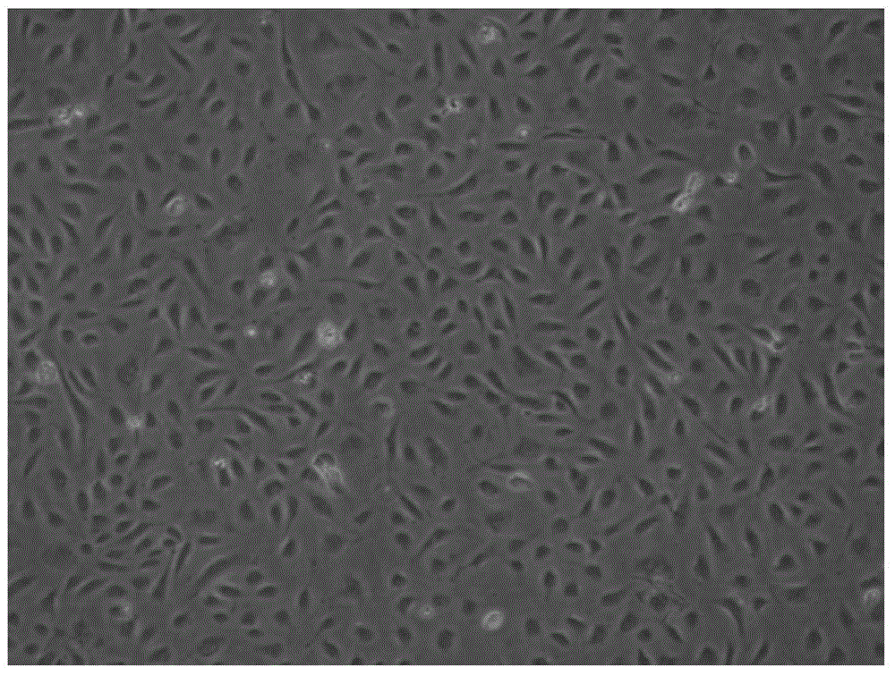 Method for improving proliferation ability and performance of umbilical cord blood OECs (outgrowth endothelial cells)