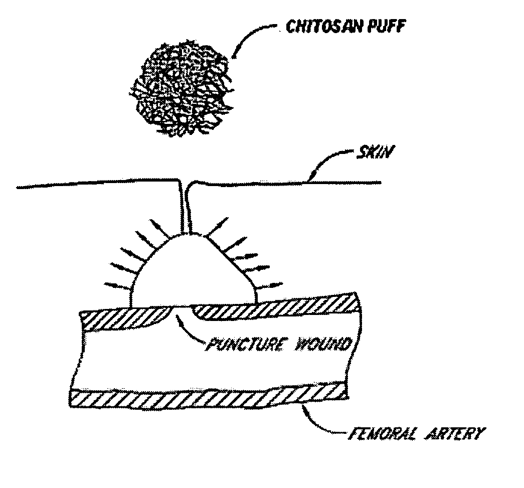 Hemostatic agent for topical and internal use