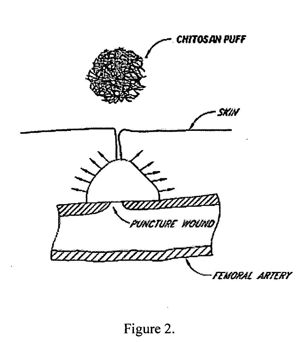 Hemostatic agent for topical and internal use